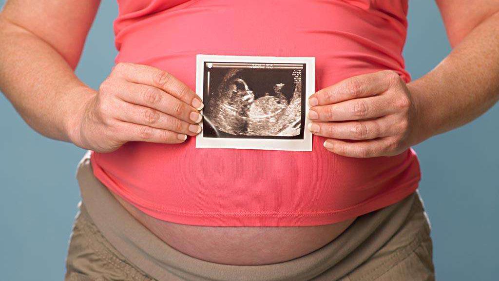 癫痫怀孕女性血药浓度监测